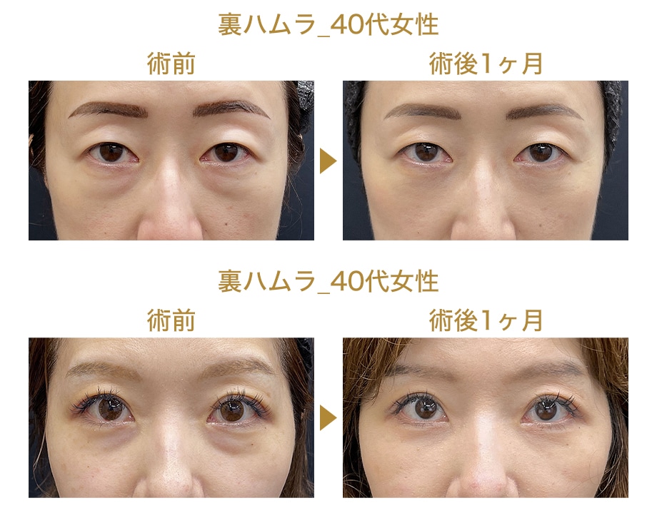 ピックアップ症例写真