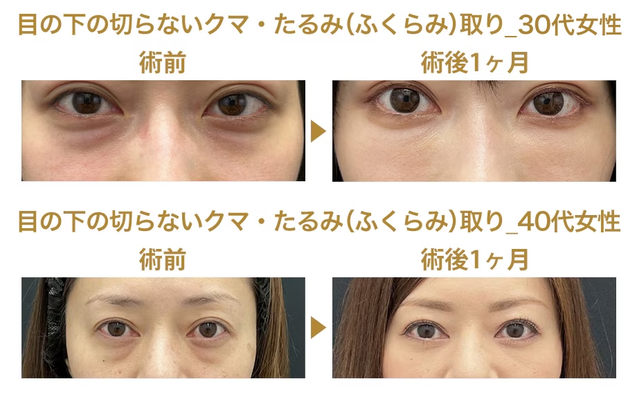 ピックアップ症例写真