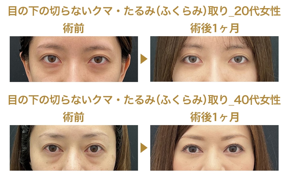 ピックアップ症例写真