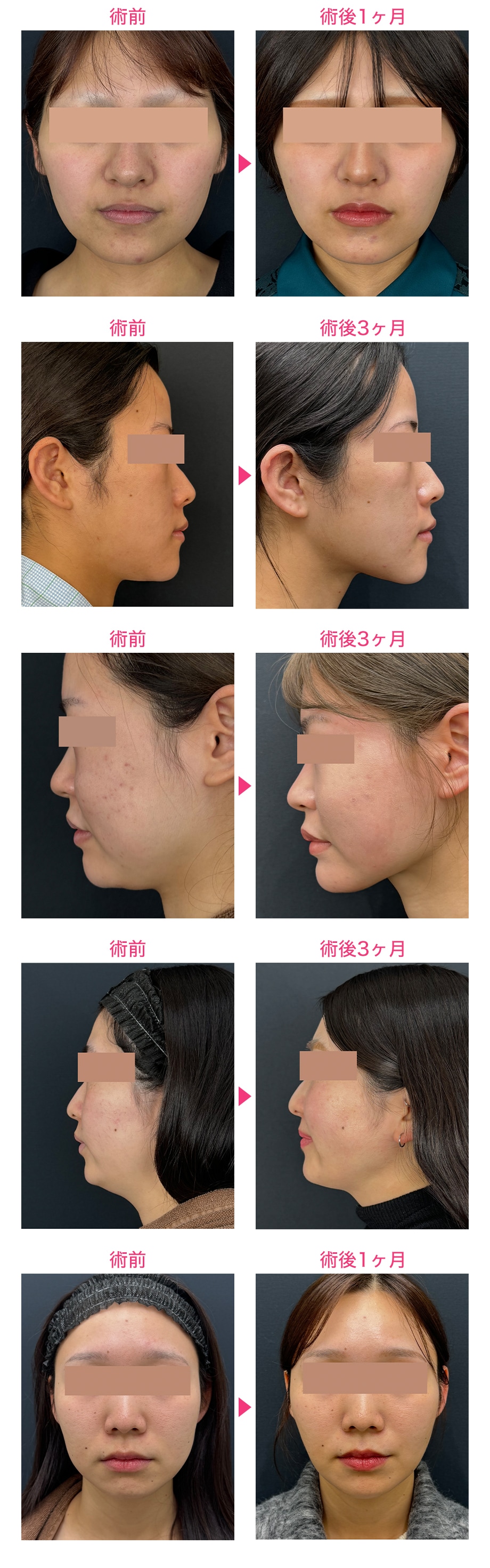 ピックアップ症例写真