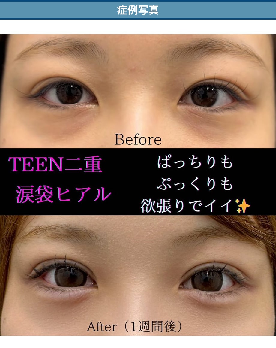 料金下症例写真