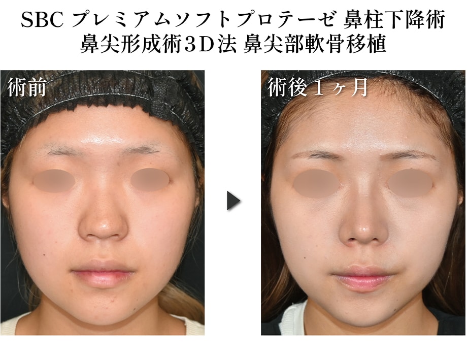 ピックアップ症例写真