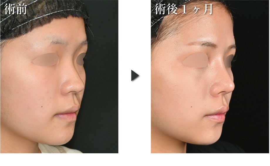 ピックアップ症例写真