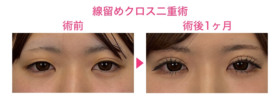 ピックアップ症例写真
