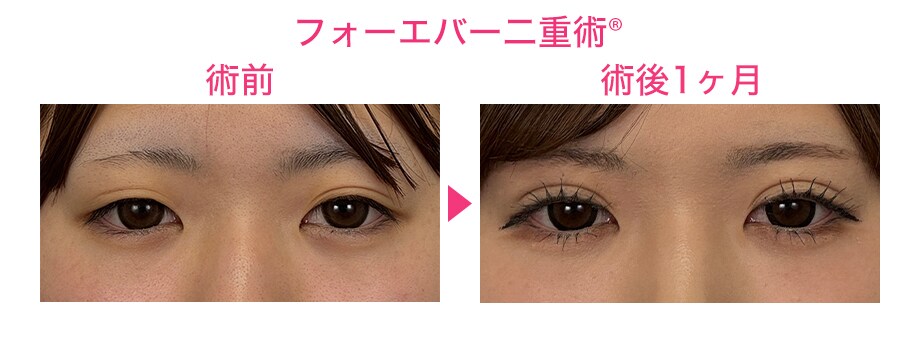 ピックアップ症例写真