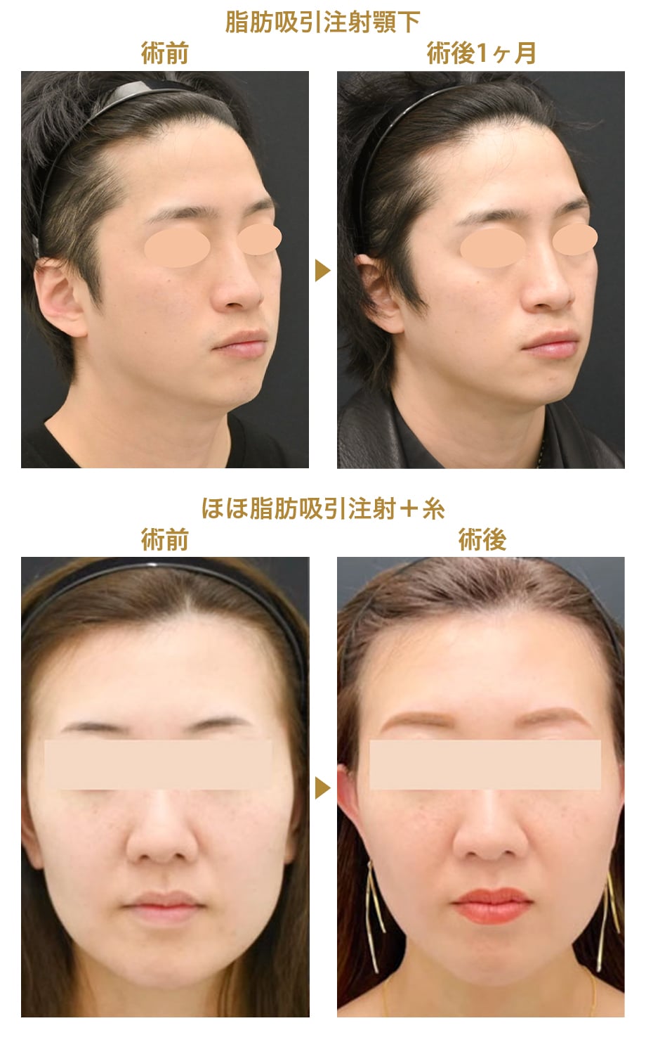ピックアップ症例写真
