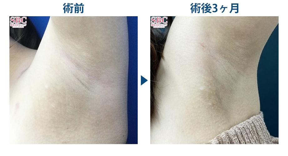 ピックアップ症例写真