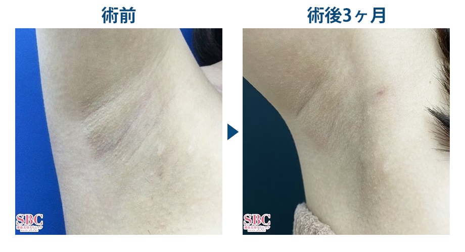 ピックアップ症例写真