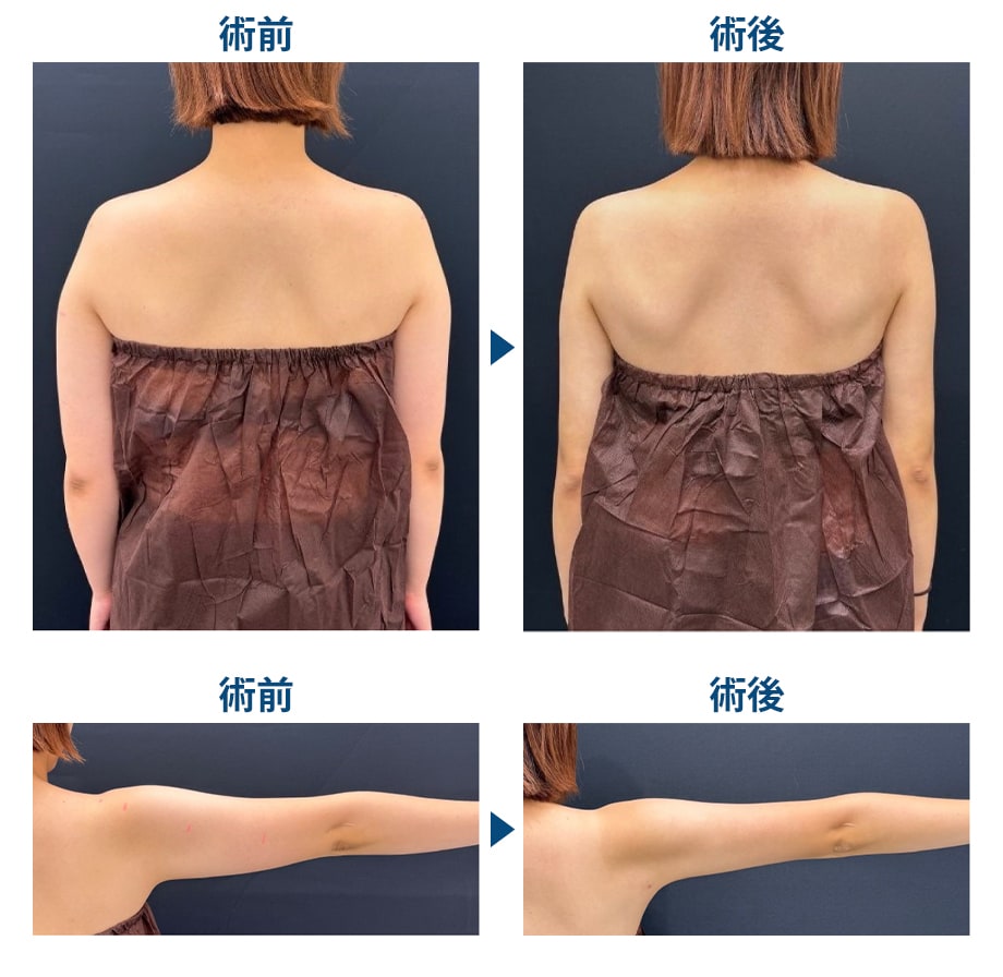 ピックアップ症例写真