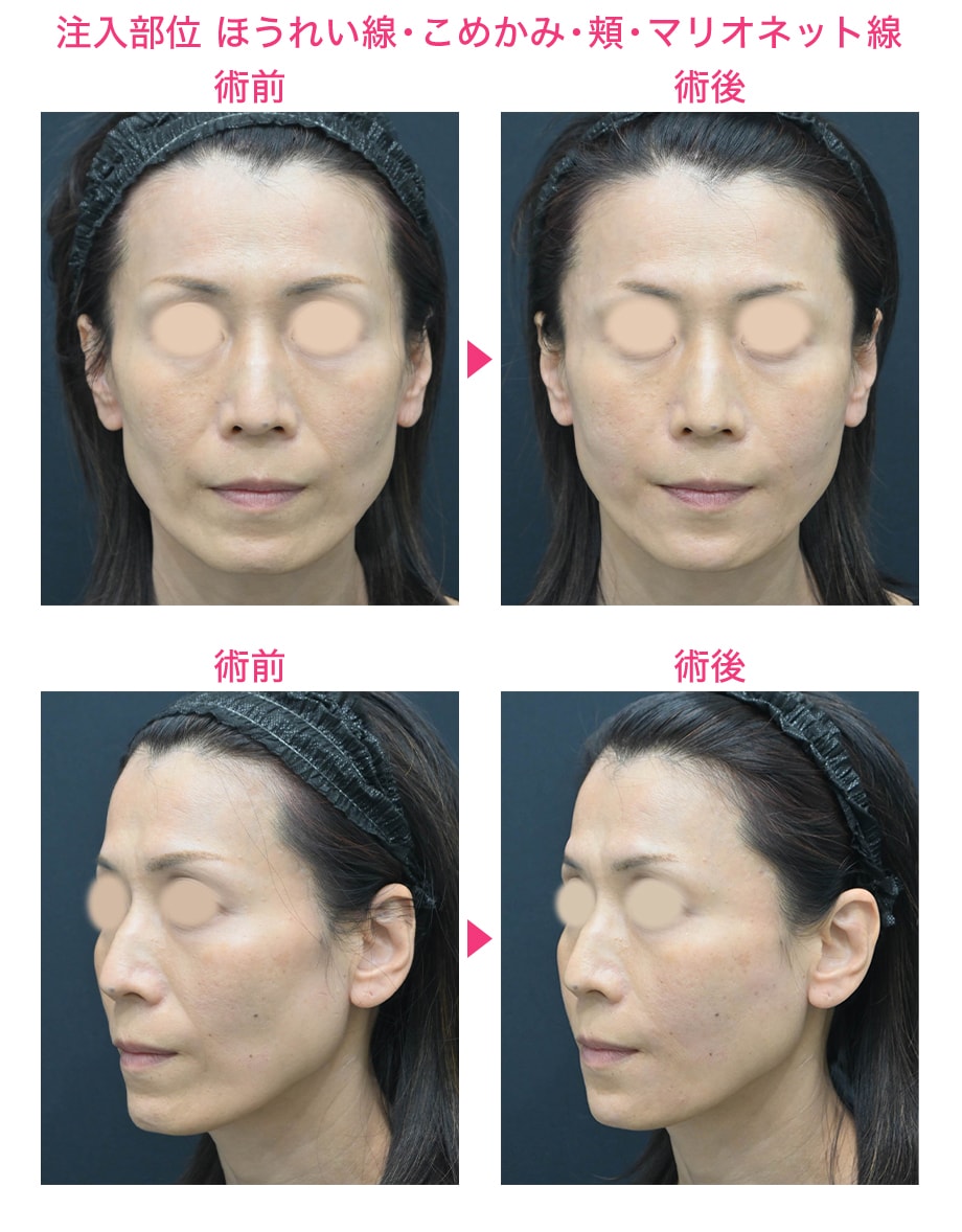 ピックアップ症例写真