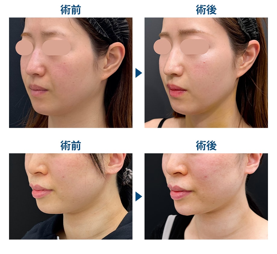 料金下症例写真