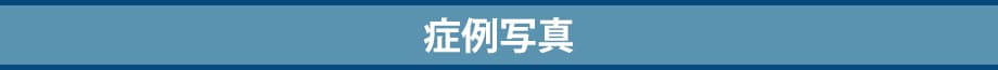 料金下症例写真