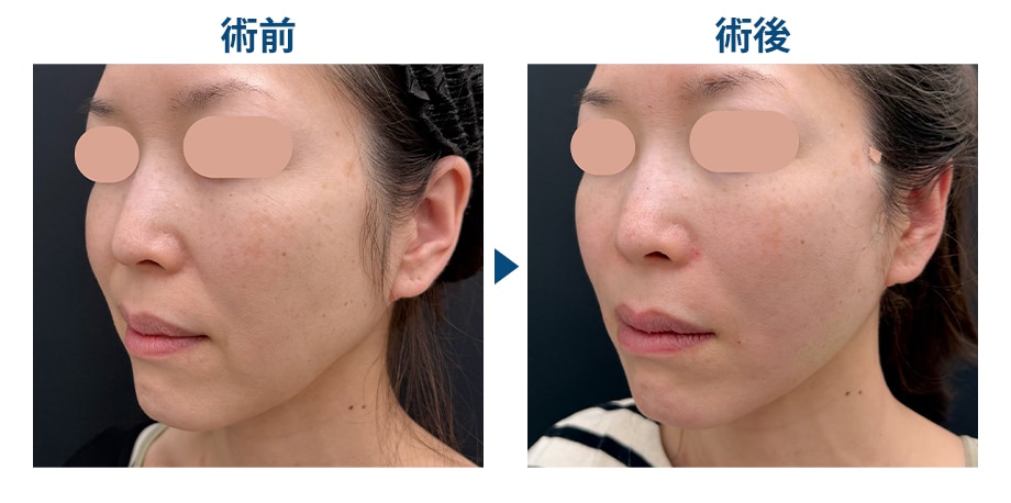 料金下症例写真