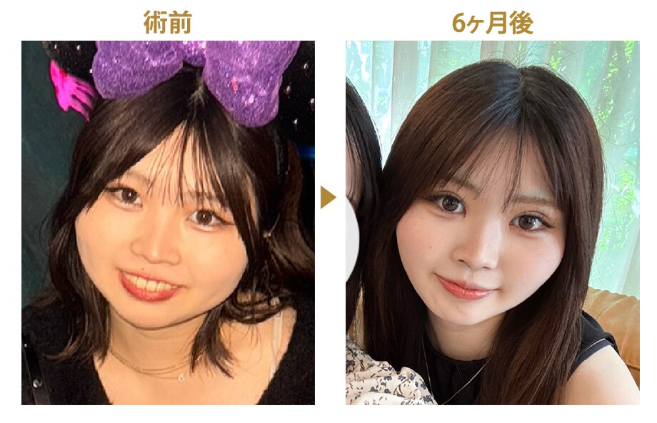 ピックアップ症例写真