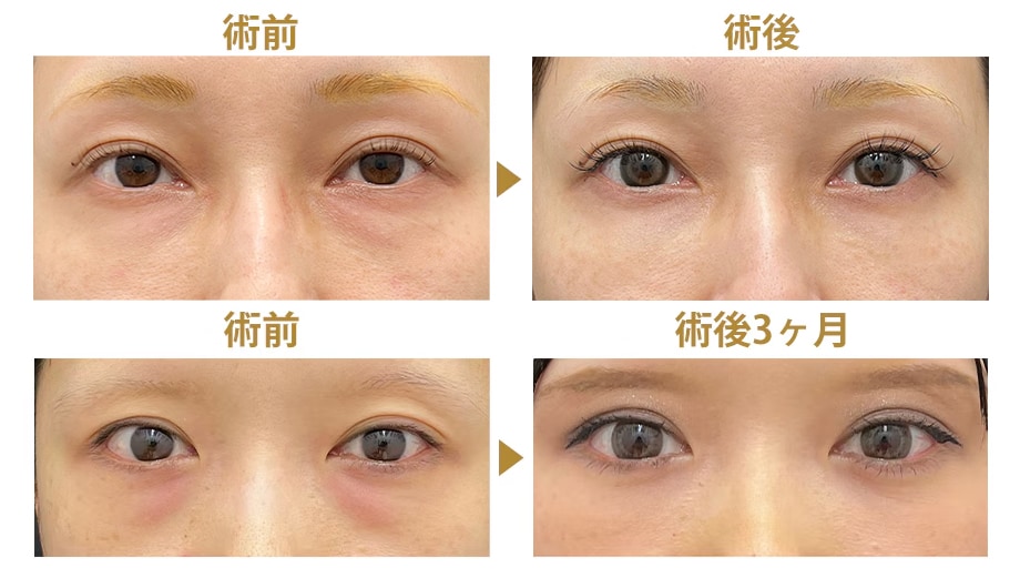 ピックアップ症例写真