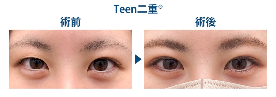 料金下症例写真