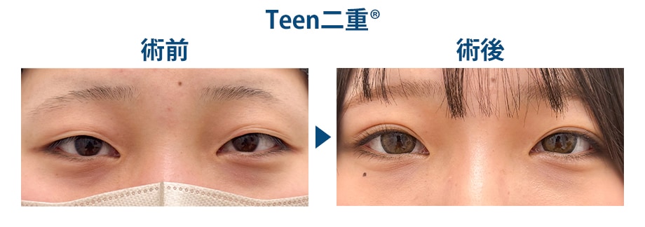 料金下症例写真