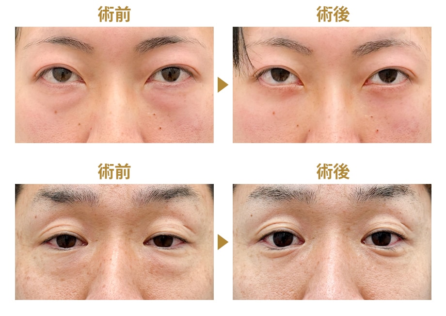 ピックアップ症例写真