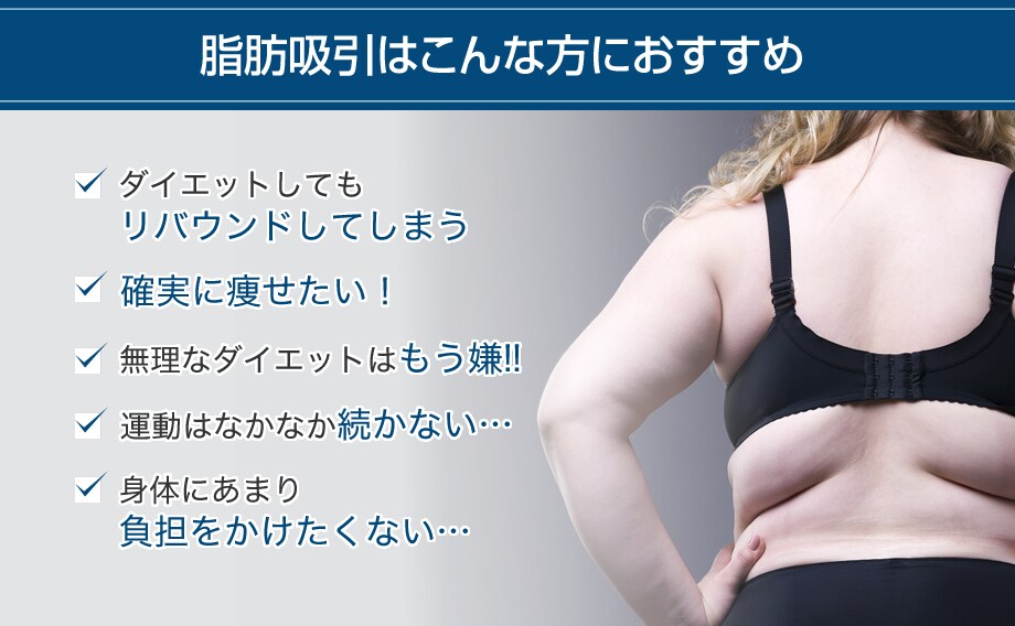 美容外科専門医 お腹の脂肪吸引専門 脂肪吸引モニター募集 美容整形 美容外科の湘南美容クリニック 美容外科専門医 お腹の脂肪吸引専門 脂肪吸引モニター募集 美容整形 美容外科の湘南美容クリニック