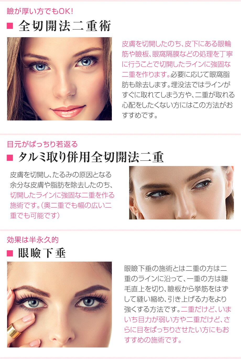 美容外科専門医 慶應医学部卒のベテラ 二重 二重整形モニター募集 美容整形 美容外科の湘南美容クリニック 美容外科専門医 慶應医学部卒のベテラ 二重 二重整形モニター募集 美容整形 美容外科の湘南美容クリニック
