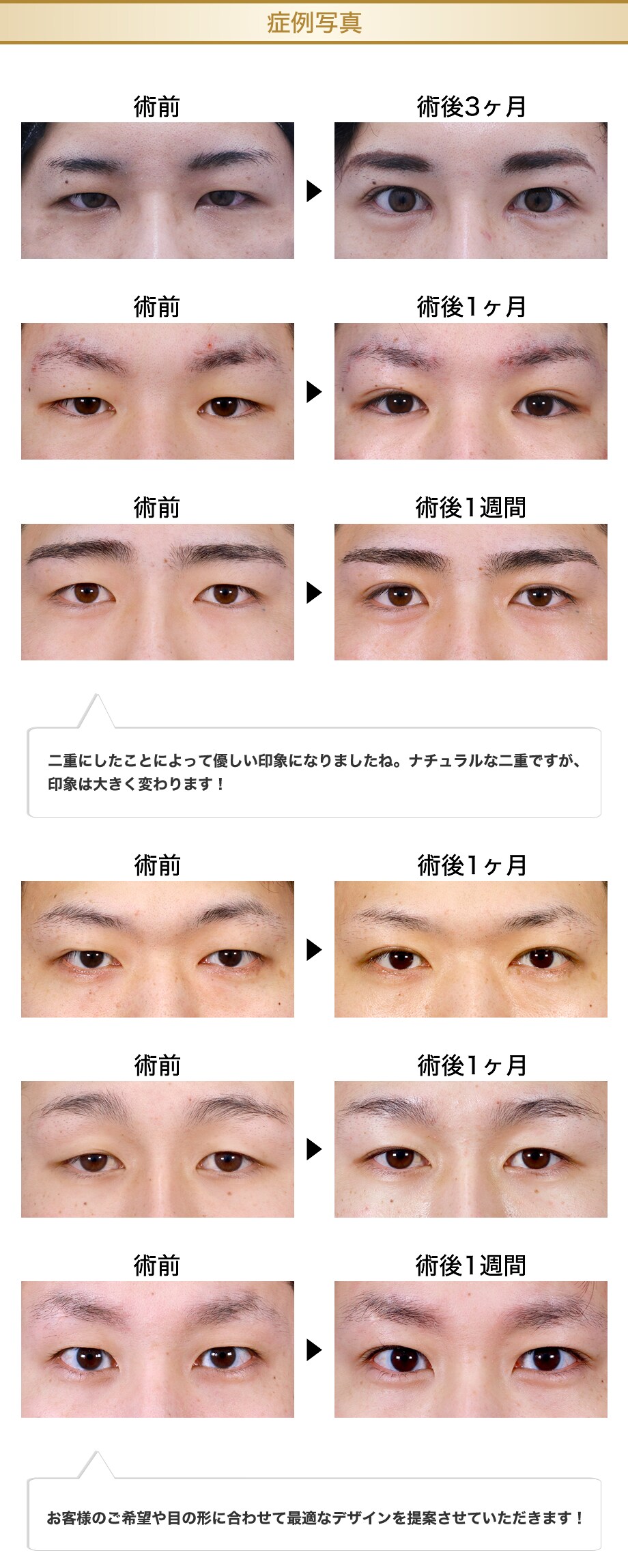 症例写真