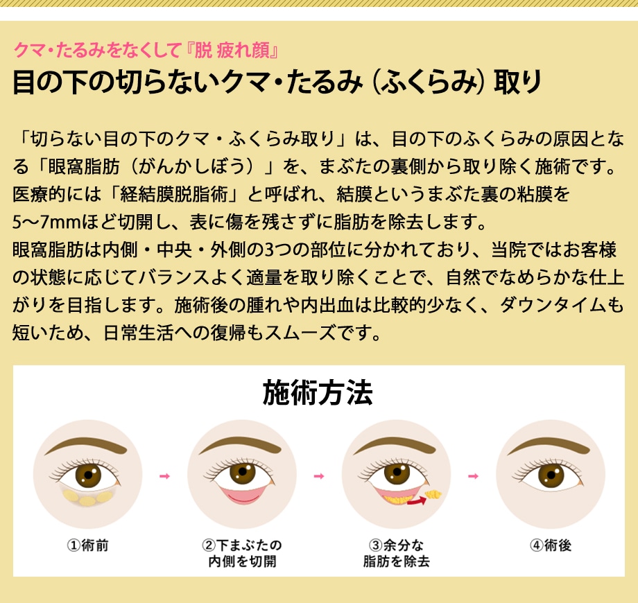 切らないクマ取り