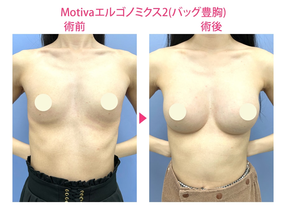 ピックアップ症例写真