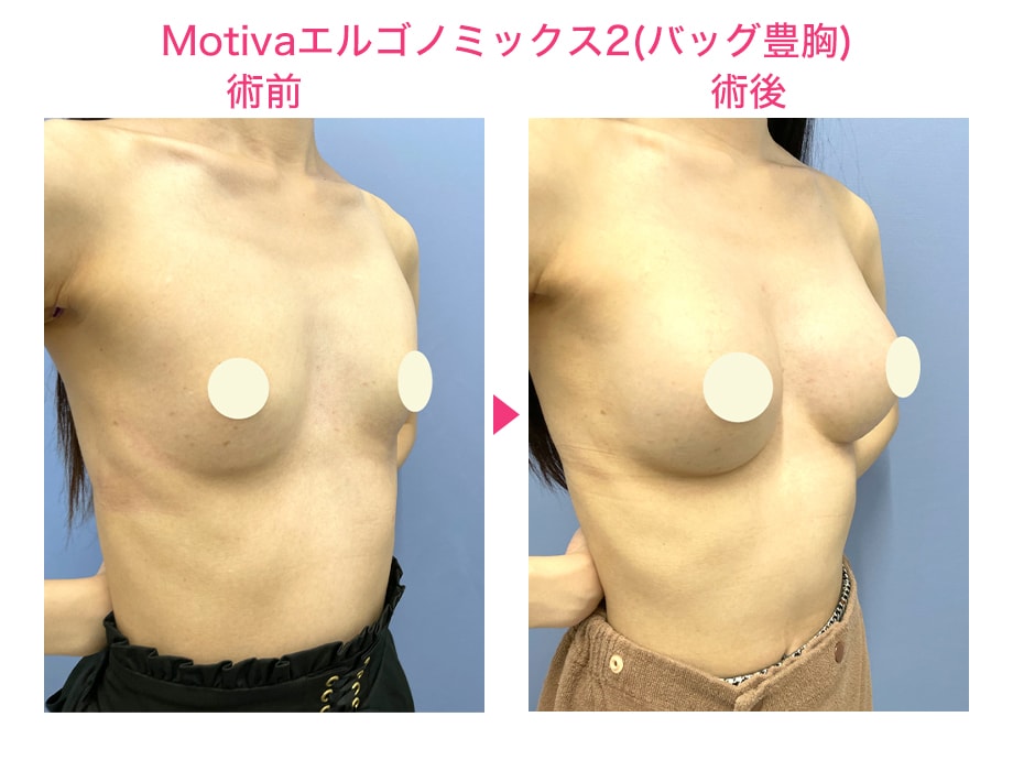 ピックアップ症例写真