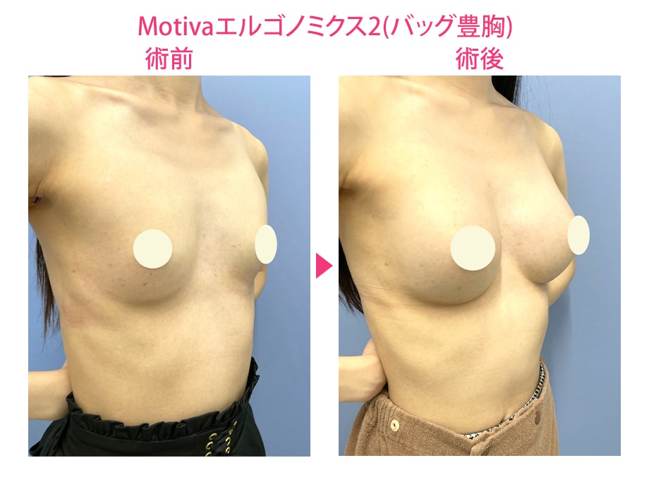ピックアップ症例写真