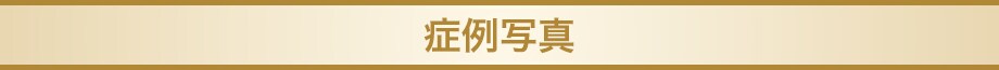 料金下症例写真