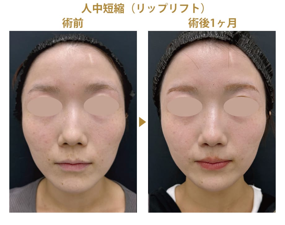 ピックアップ症例写真