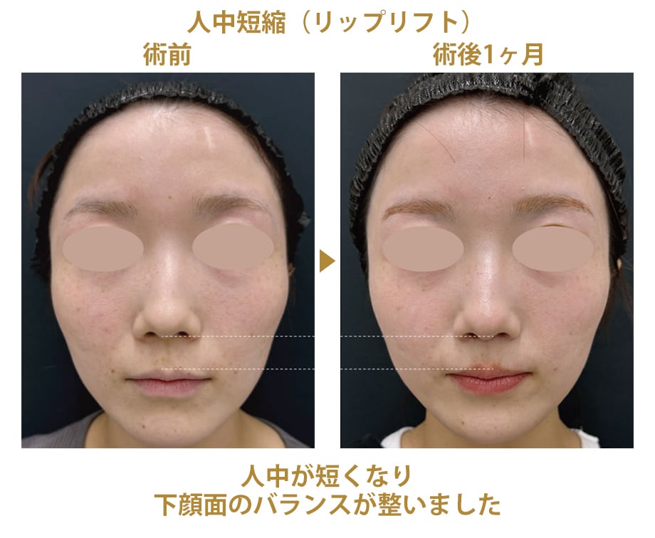 ピックアップ症例写真