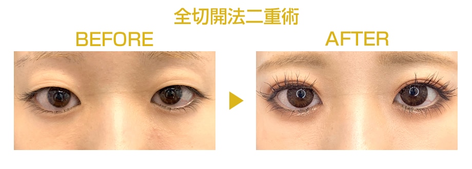 ピックアップ症例写真