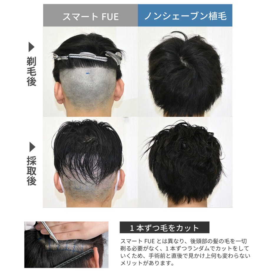 解説