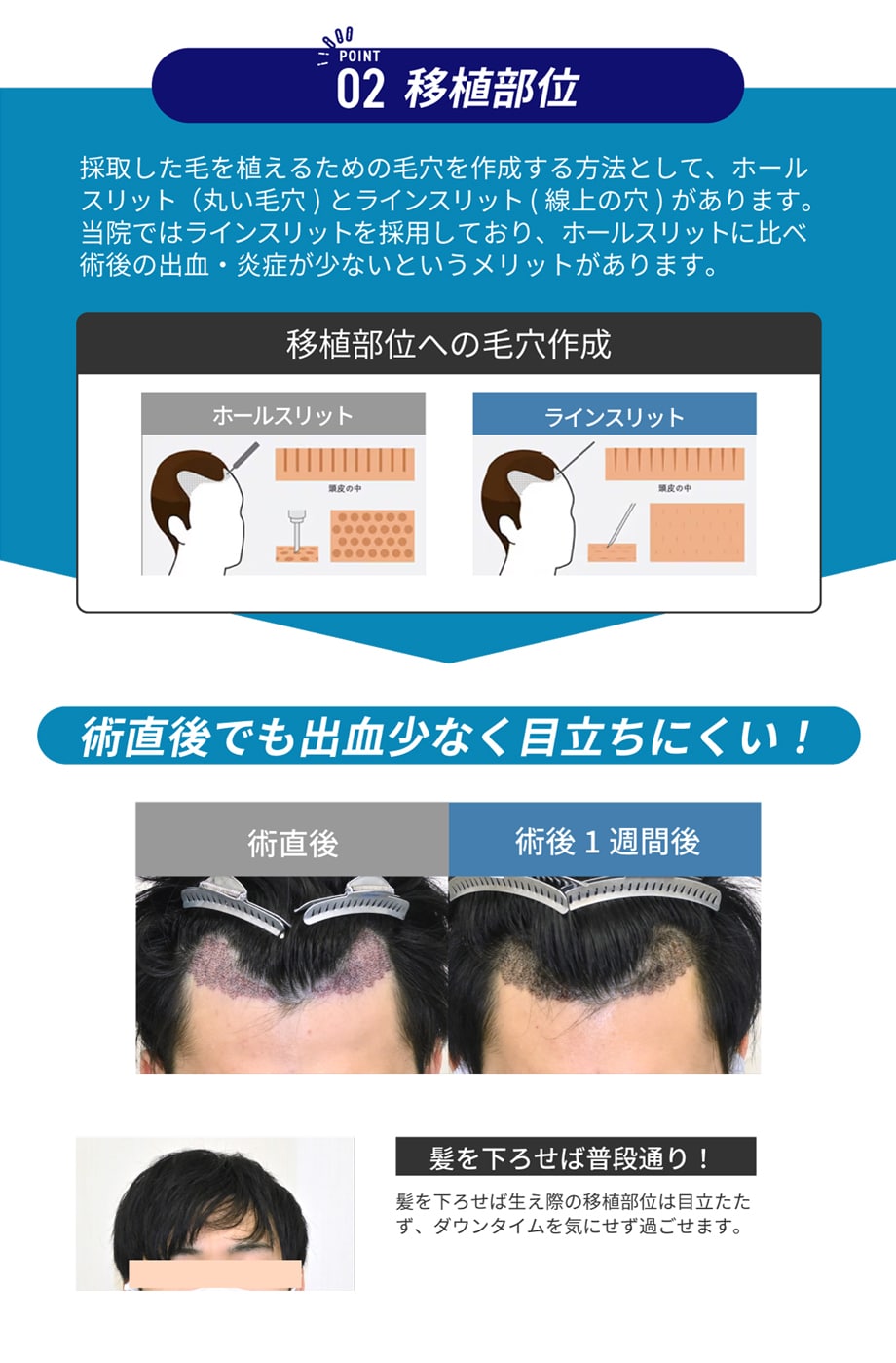 解説