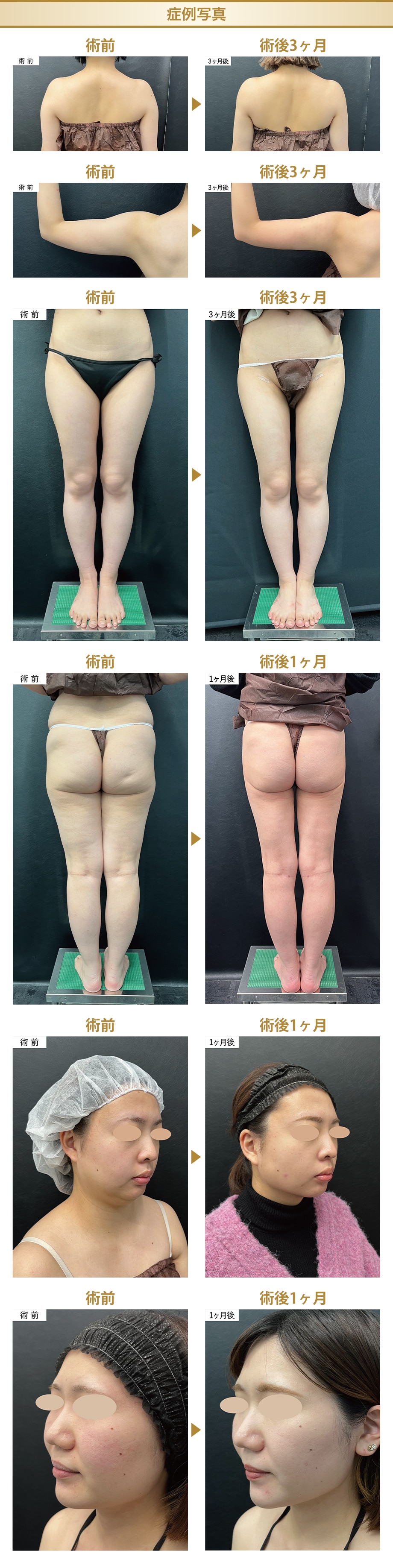 モニター募集