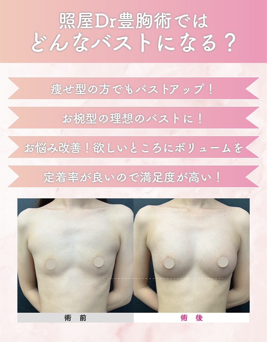 メイン下症例写真