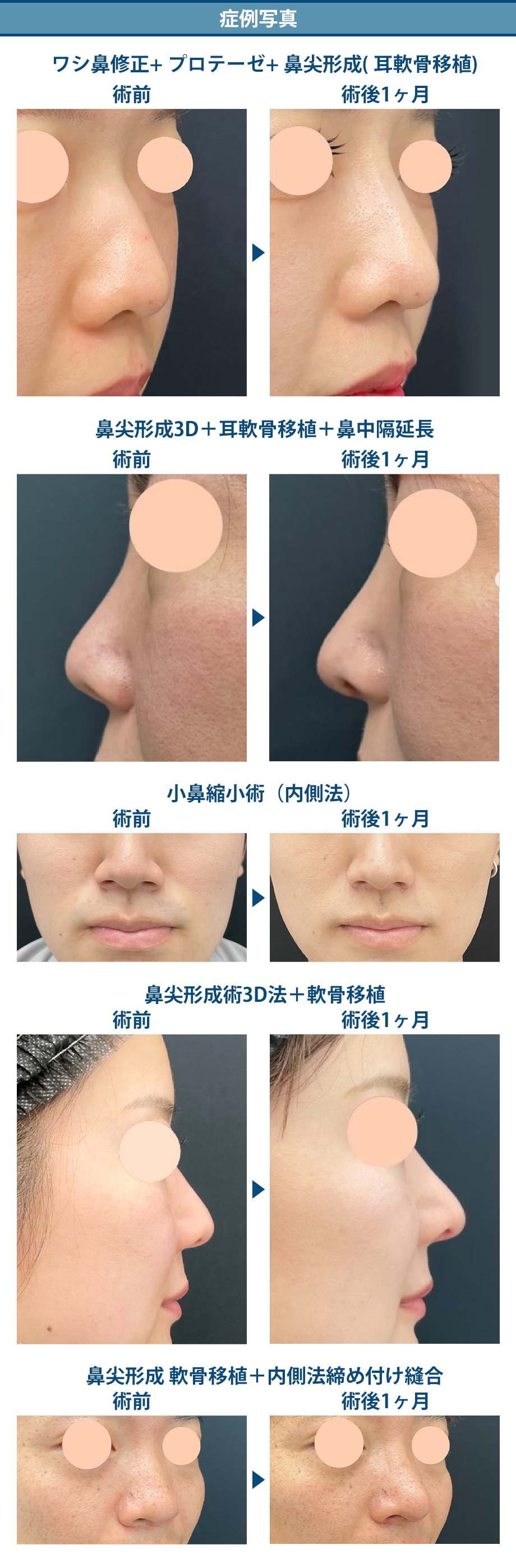 料金下症例写真