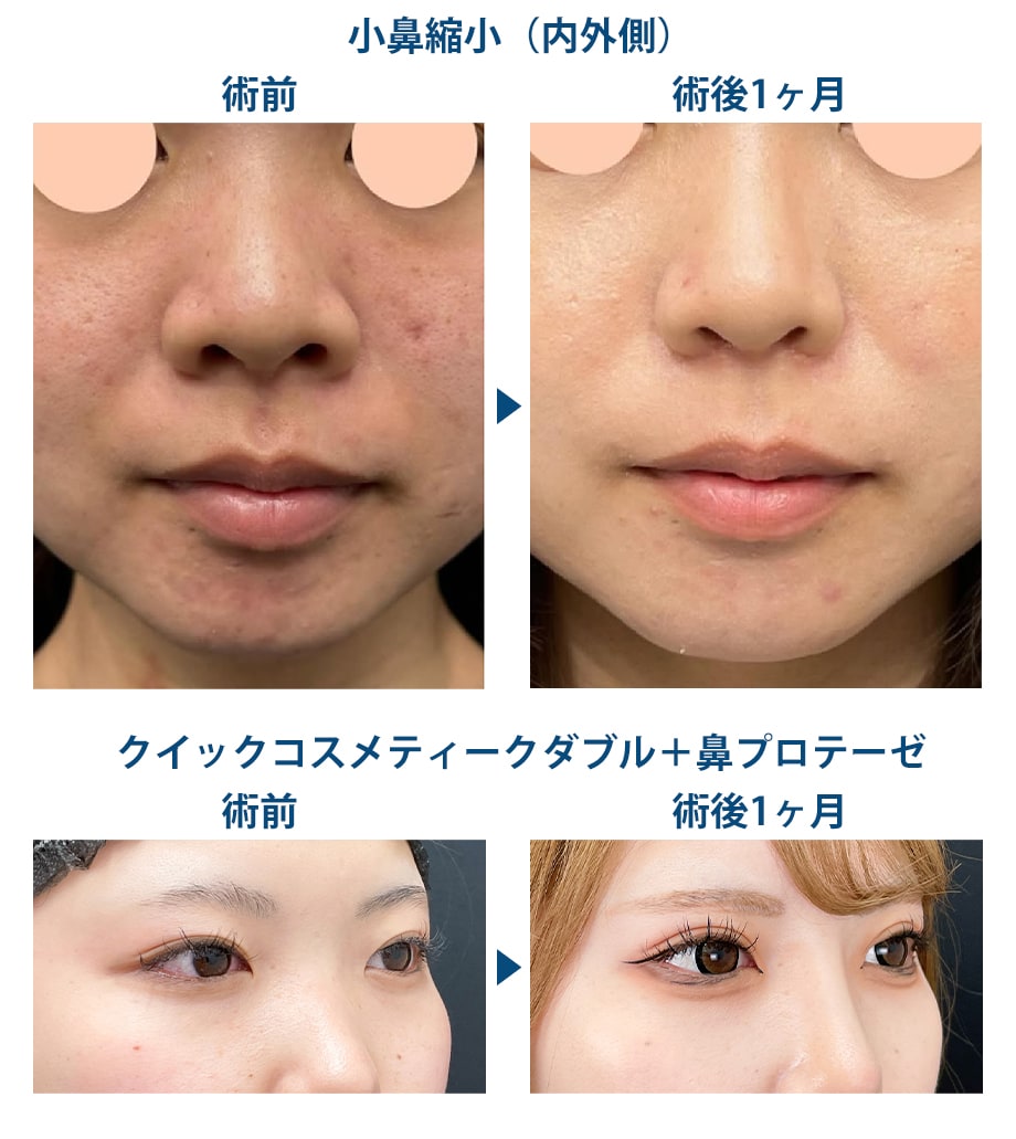 ピックアップ症例写真