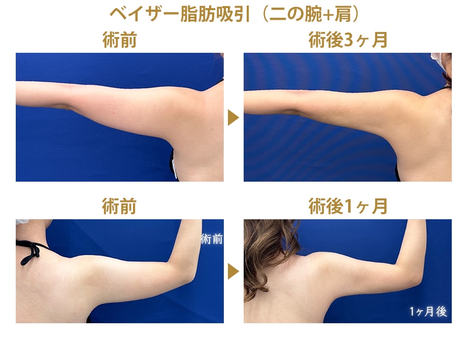 ピックアップ症例写真