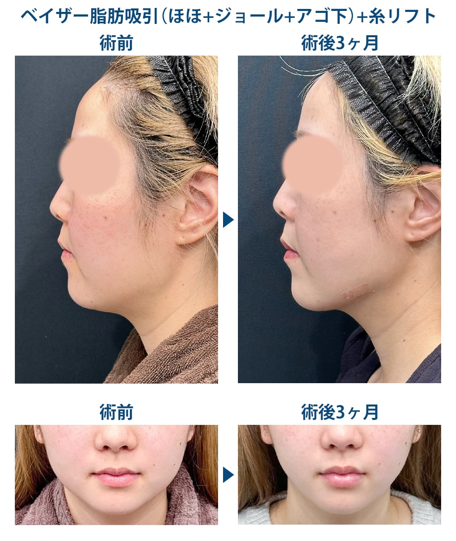 ピックアップ症例写真