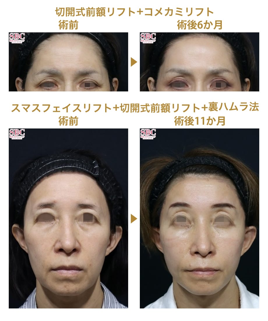 ピックアップ症例写真