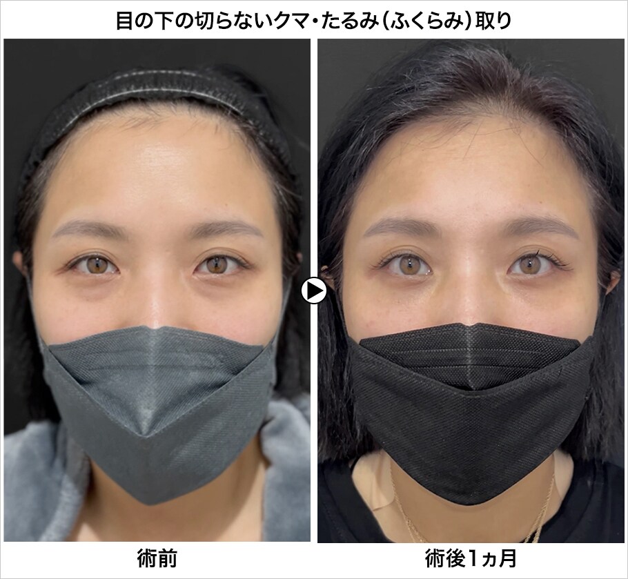 メイン下症例写真