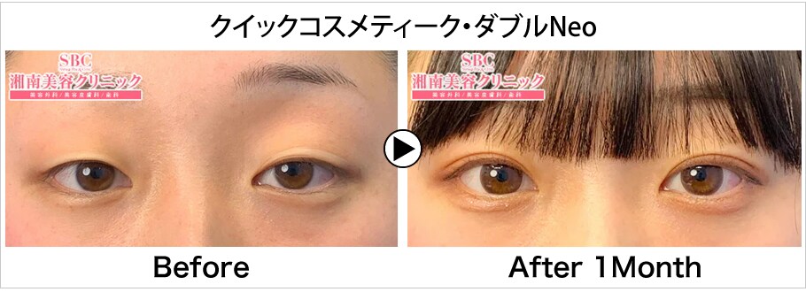 モニター募集