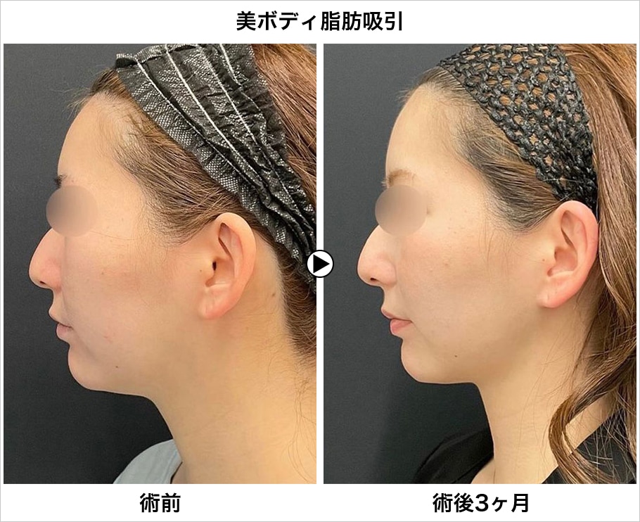メイン下症例写真