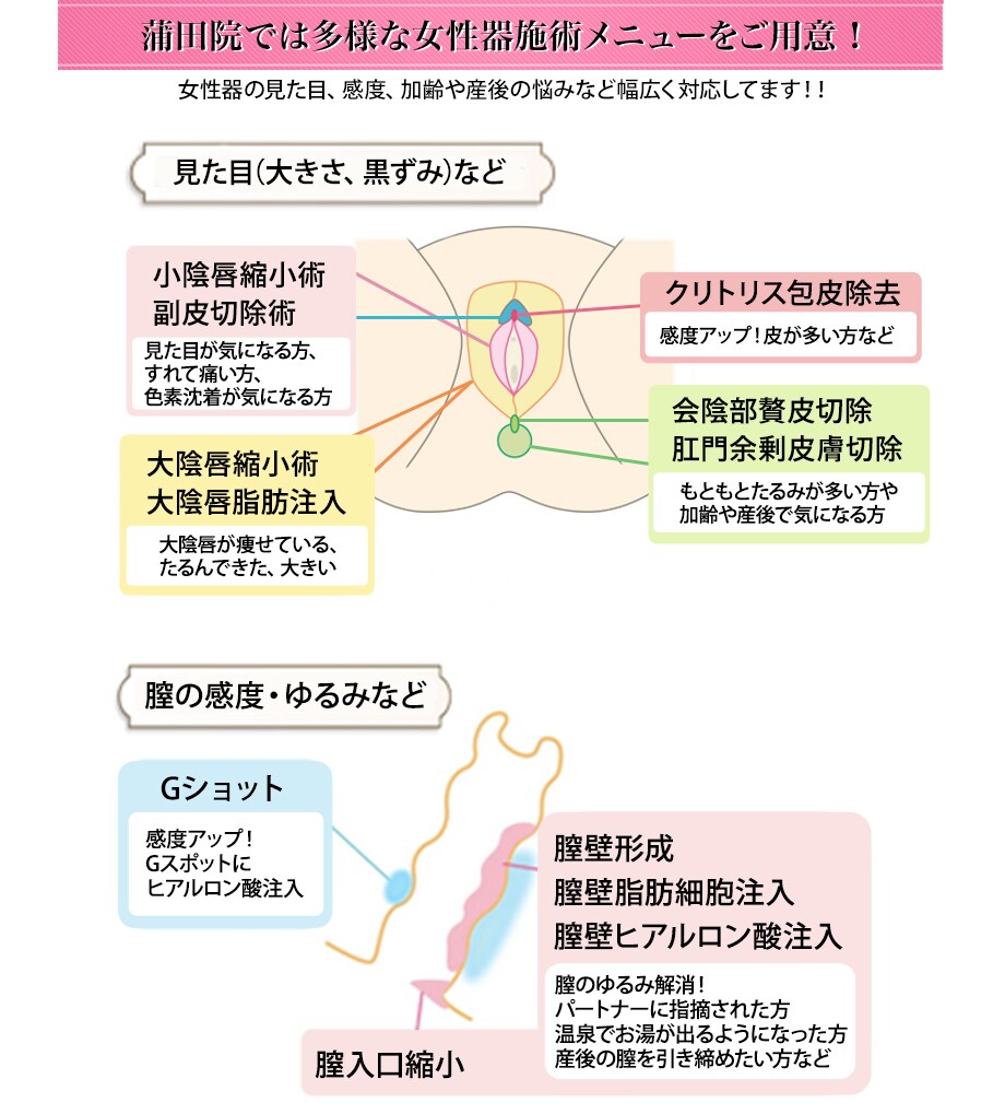 女性器の見た目 感度 膣のお悩み 性交痛 婦人科形成モニター募集 美容整形 美容外科の湘南美容クリニック 女性器の見た目 感度 膣のお悩み 性交痛 婦人科形成モニター募集 美容整形 美容外科の湘南美容クリニック