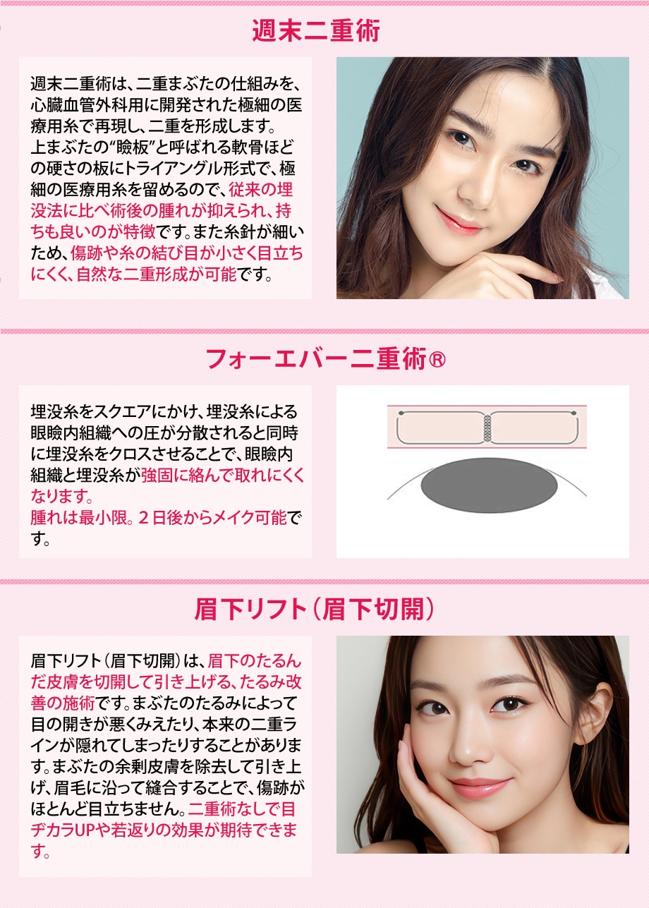 施術解説小カテ