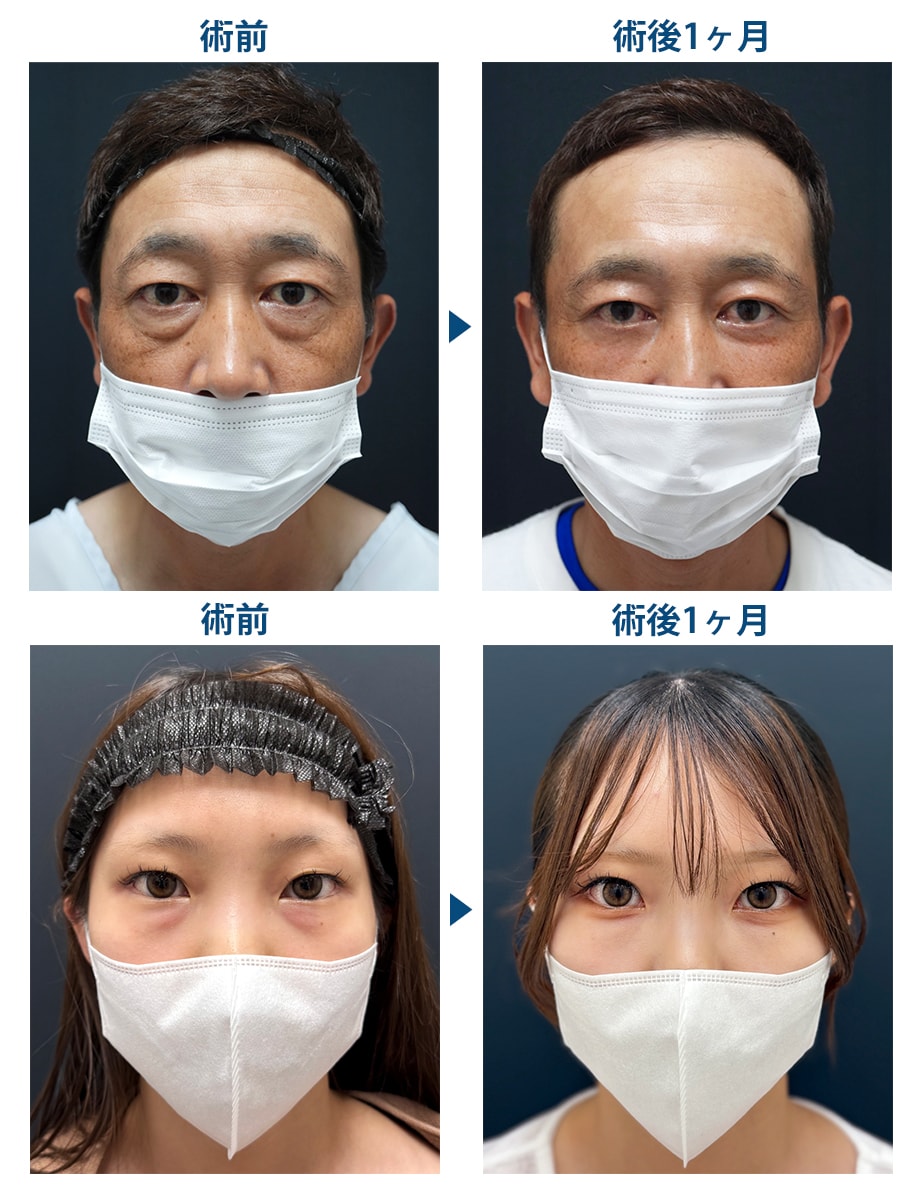 ピックアップ症例写真