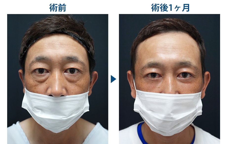 ピックアップ症例写真