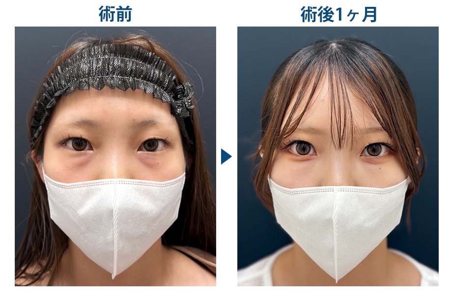 ピックアップ症例写真
